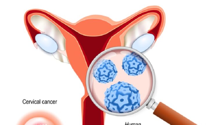 مسببات سرطان عنق الرحم