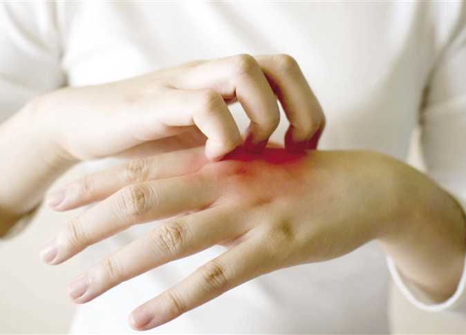 علاج امراض الجلد الفطرية