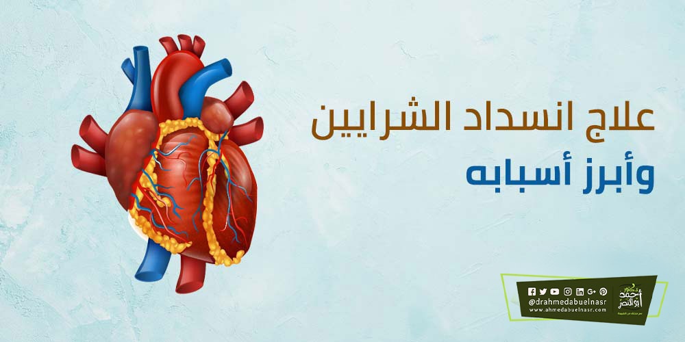 علاج انسداد شرايين القلب بدون جراحة