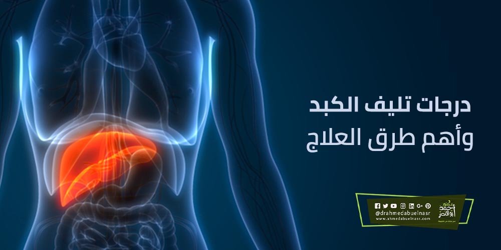 درجات تليف الكبد وأهم طرق العلاج الدكتور احمد ابو النصر