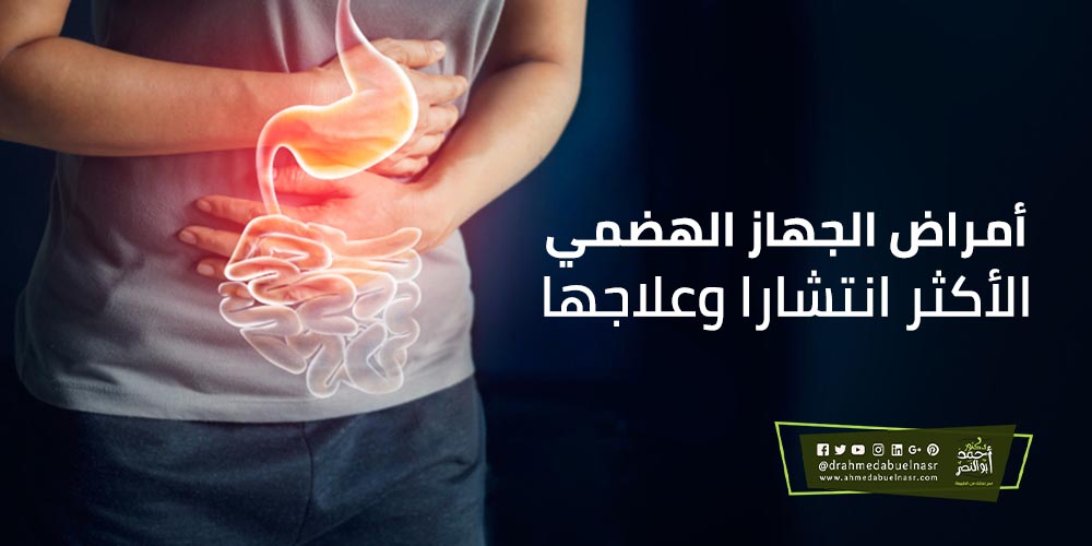 أمراض الجهاز الهضمي الأكثر انتشارا وعلاجها الدكتور احمد ابو النصر