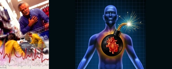 هل تضخم عضلة القلب خطير و هل يمكن أن يسبب الوفاة ؟